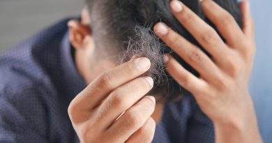 Mayo Clinic: Recomendaciones prácticas para tratar la caída del cabello